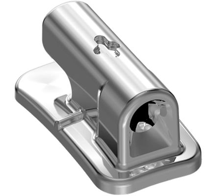 Tubo ADV Colagem Edgewise 022 Simples Sup/Inf E/D 21.02.1017 - Orthometric